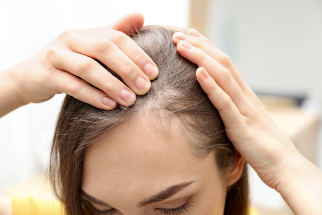 Queda de Cabelo Dra. Paula Azevedo Dermatologista Goiânia Exossomos PDRN MesojectGun Fotona 5D