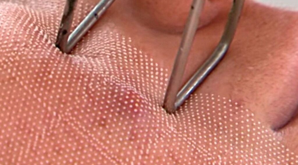 HYBRID CO2 O Novo Fenol