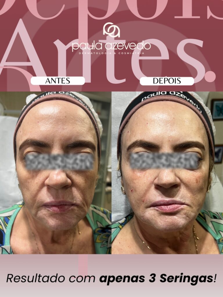 Instagram post from drapaulaazevedodermato. This post is in position 2.